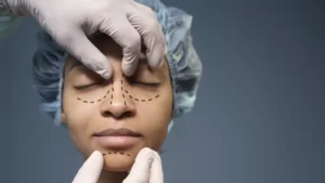 مقالات 2 بهترین جراحان عمل بینی در کرج